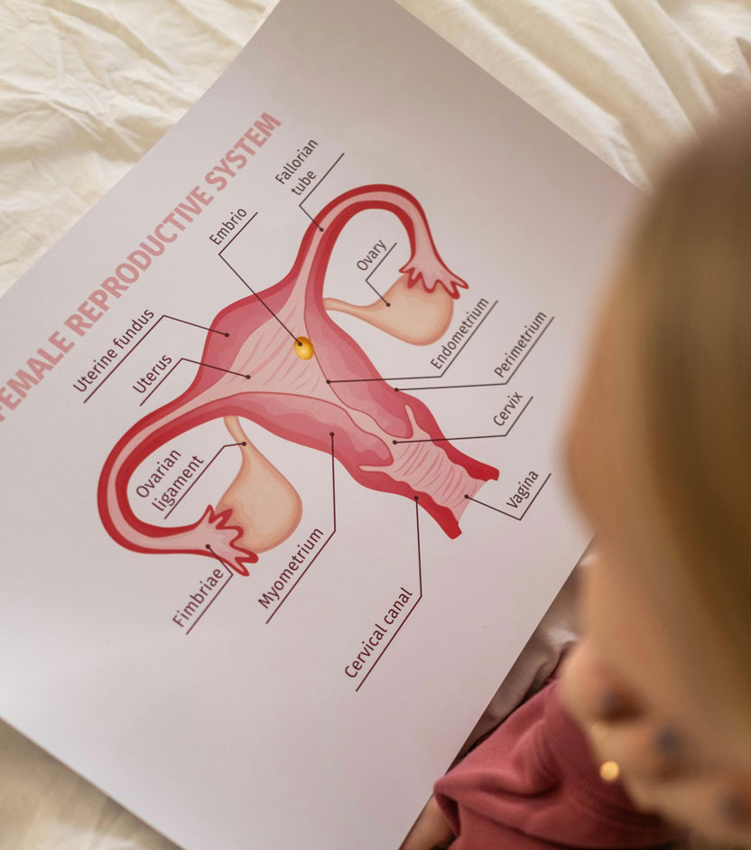 A mióma műtét nélküli kezelése a mióma-embolizáció