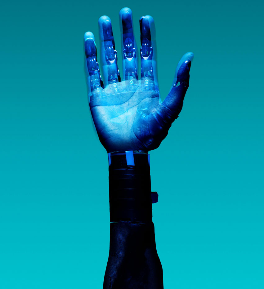 Elvégezték az első mozgásszervi (ortopédiai) robotikai műtétet a Semmelweis Egyetem