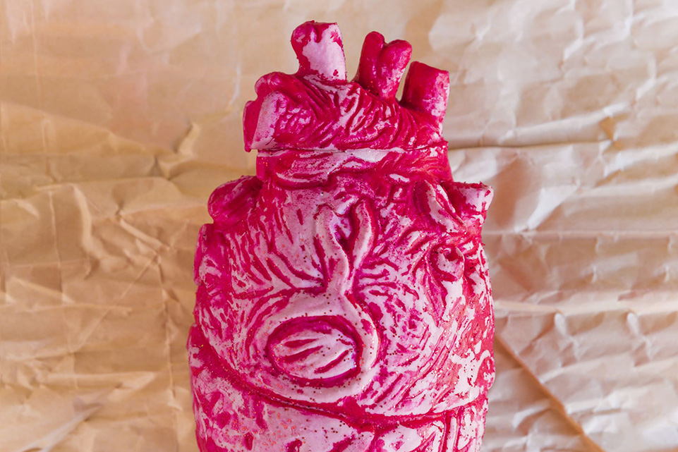 Műszív beültetés és túlélési esélyek