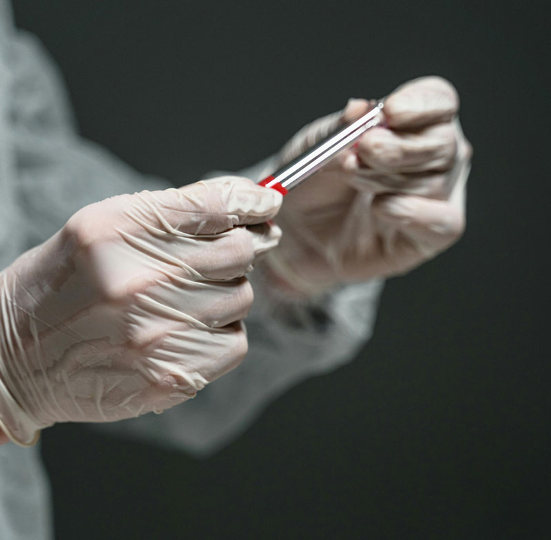 Vesebetegség a csendes gyilkos