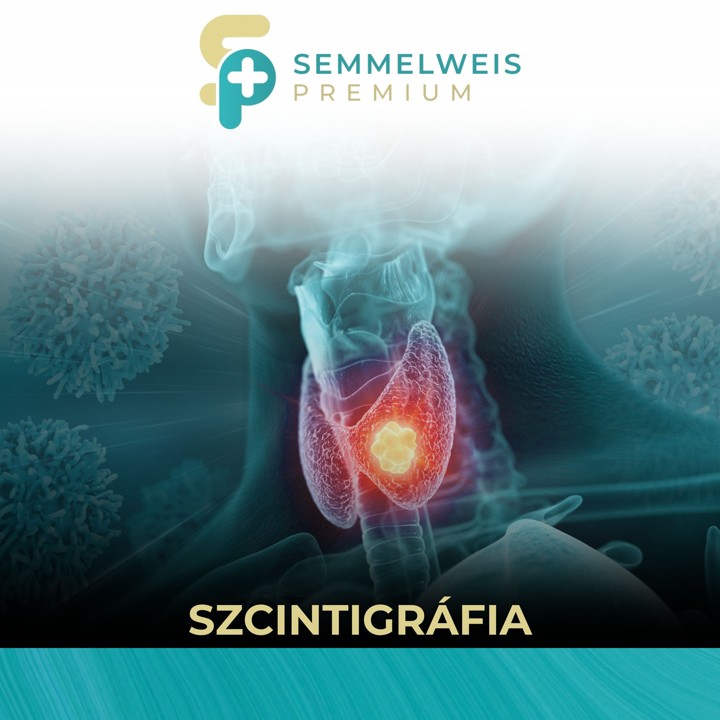 Szcintigráfia